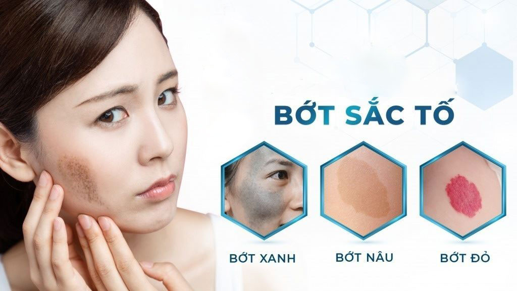 điều trị bớt sắc tố