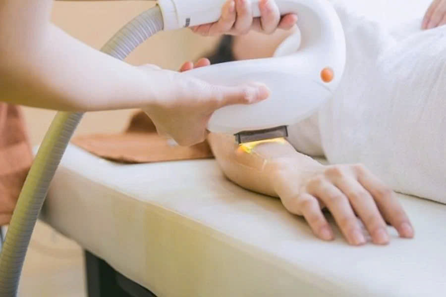 triệt lông 1/2 cánh tay