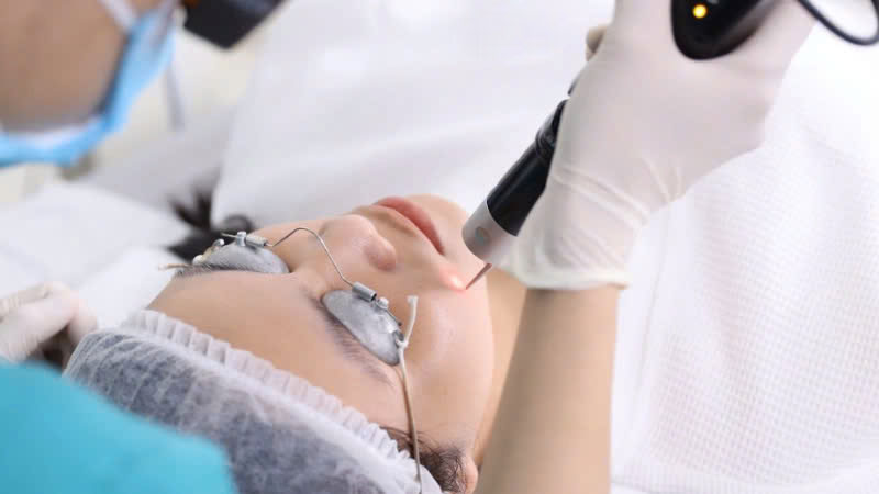 điều trị bớt sắc tố