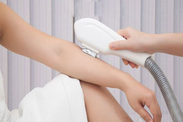 triệt lông 1/2 cánh tay