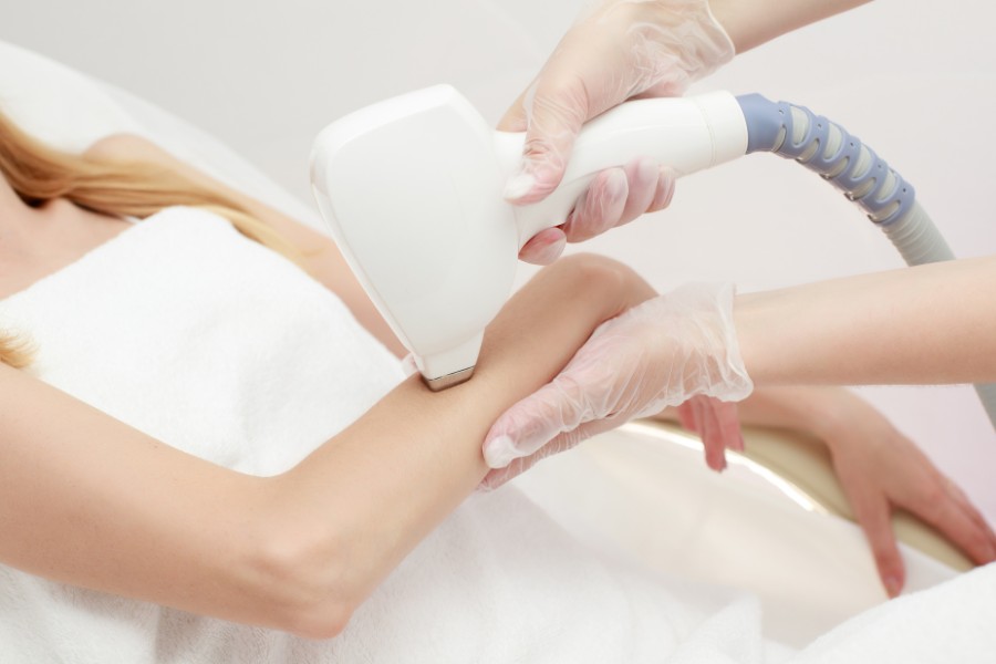 triệt lông 1/2 cánh tay