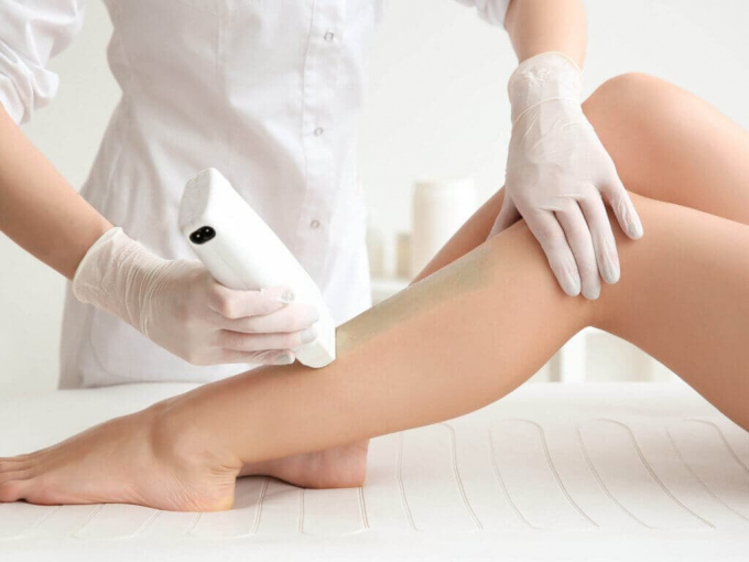 triệt lông bikini